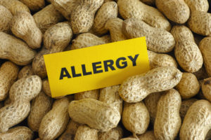 Peanut allergy