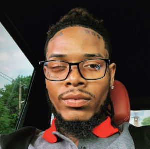 Fetty Wap