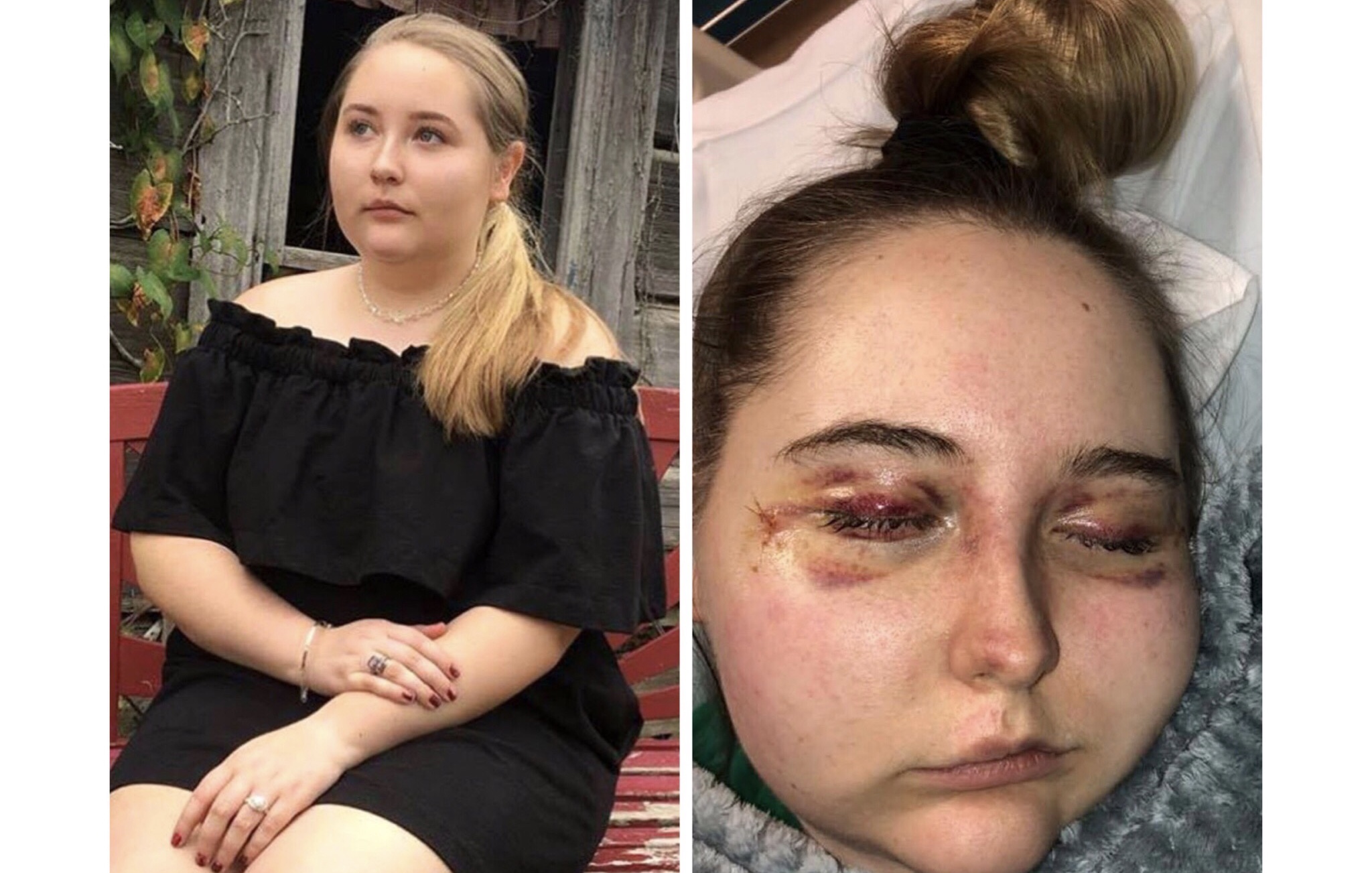 Missouri Teen Left Blind And Without Taste And Smell From Mysterious Illness After Family Cruise