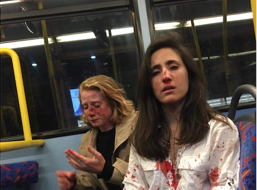 Lesbian attacked in london