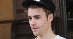 Justin Bieber talks Lyme Disease