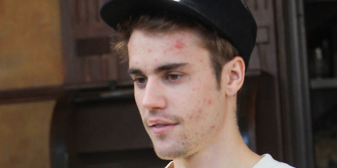 Justin Bieber talks Lyme Disease