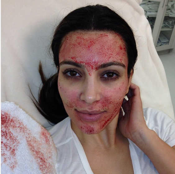 Kim Sues Over Facial