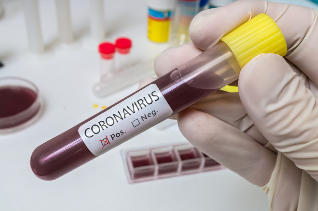Coronavirus