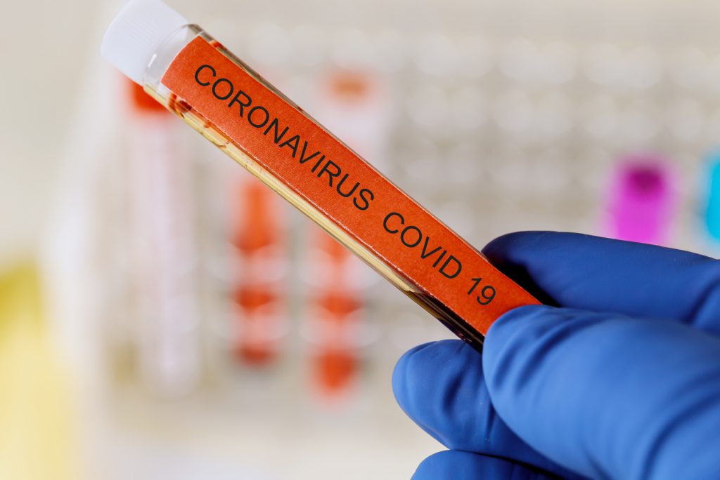 coronavirus antibodies