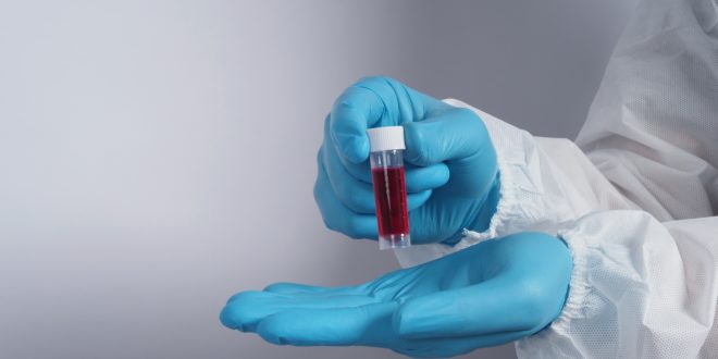 Antibody Tests