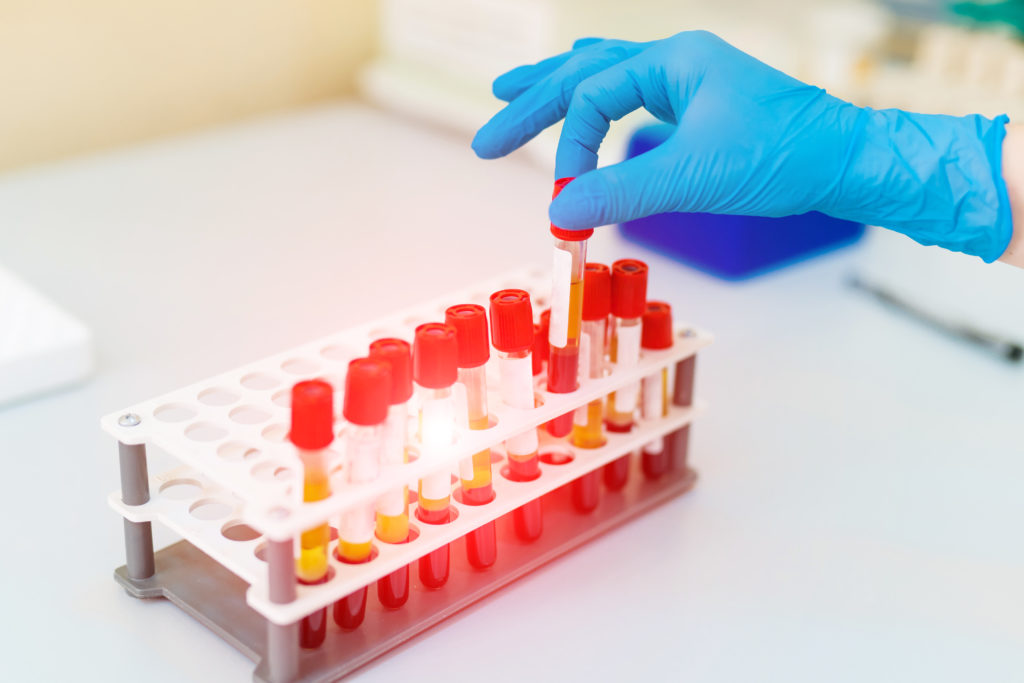 Blood Test