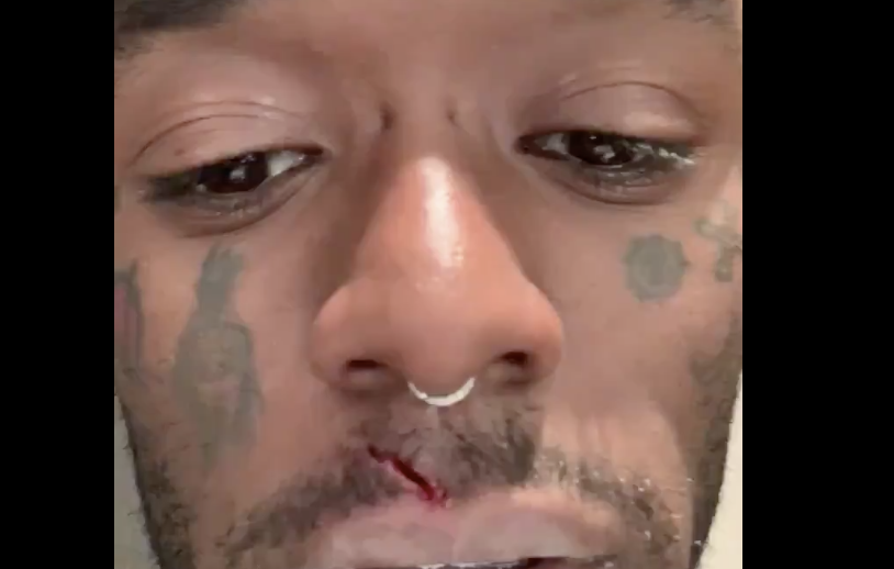 lil uzi vert - Baller Alert Lil Uzi Vert Accidentally Stabs Himself, Gives Advice About Knives After