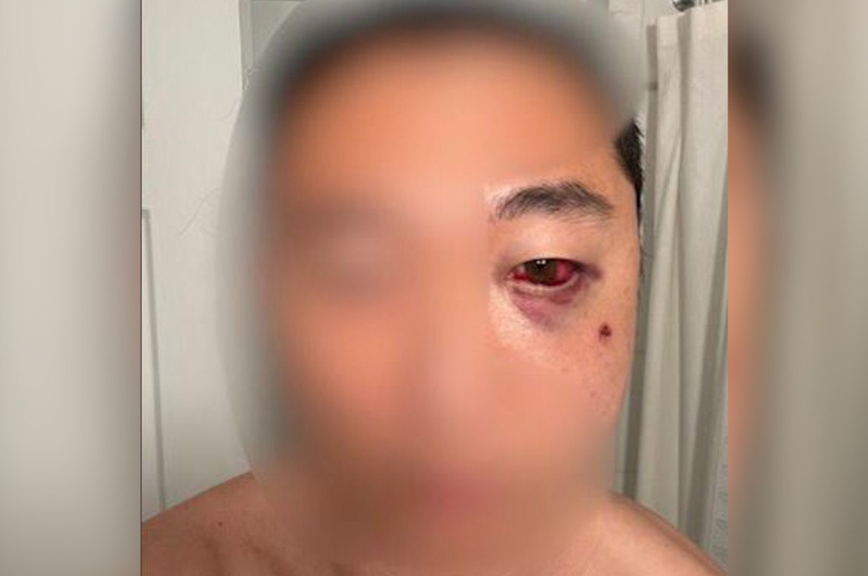 Asian Man Sucker Punched In Central Park While Spending Time With Family