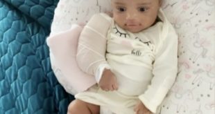 3 month old daughter arm broken