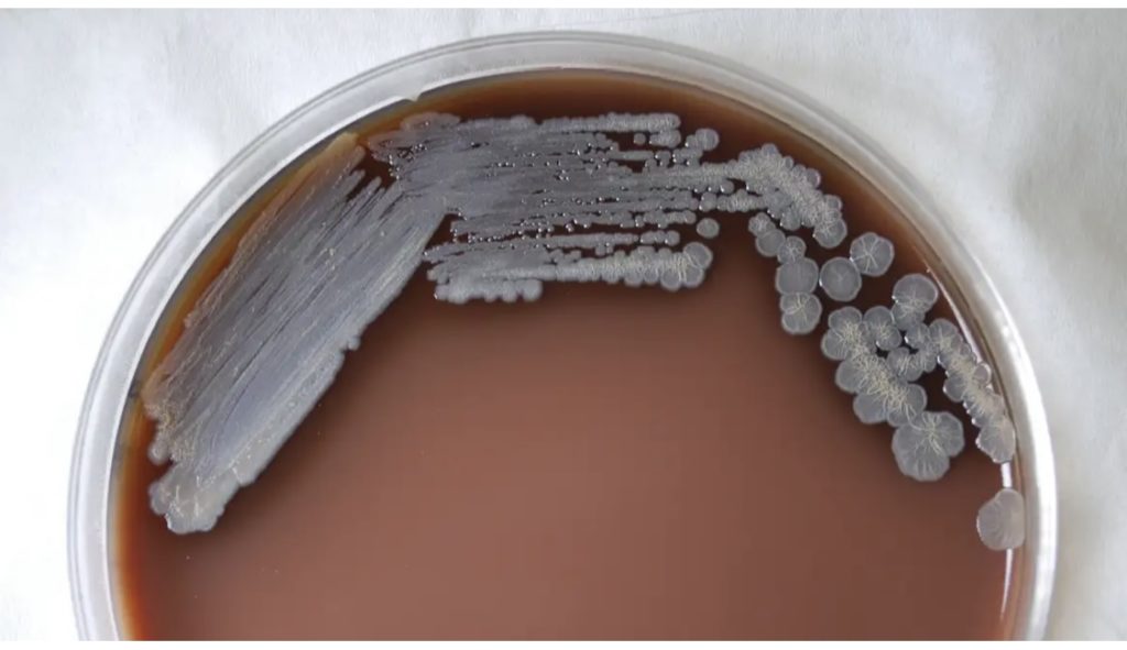 The Flesh Eating Bacteria In Gulf Waters Is Spreading North, And Warmer Water Is The Reason Why