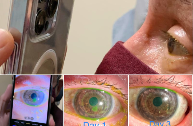 optometrist uses iphone ( tommy korn, md linkedin) - Baller Alert optometrist uses iphone