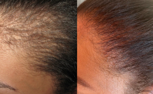 Lala hair care product