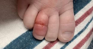Sara Ward's baby's toe.