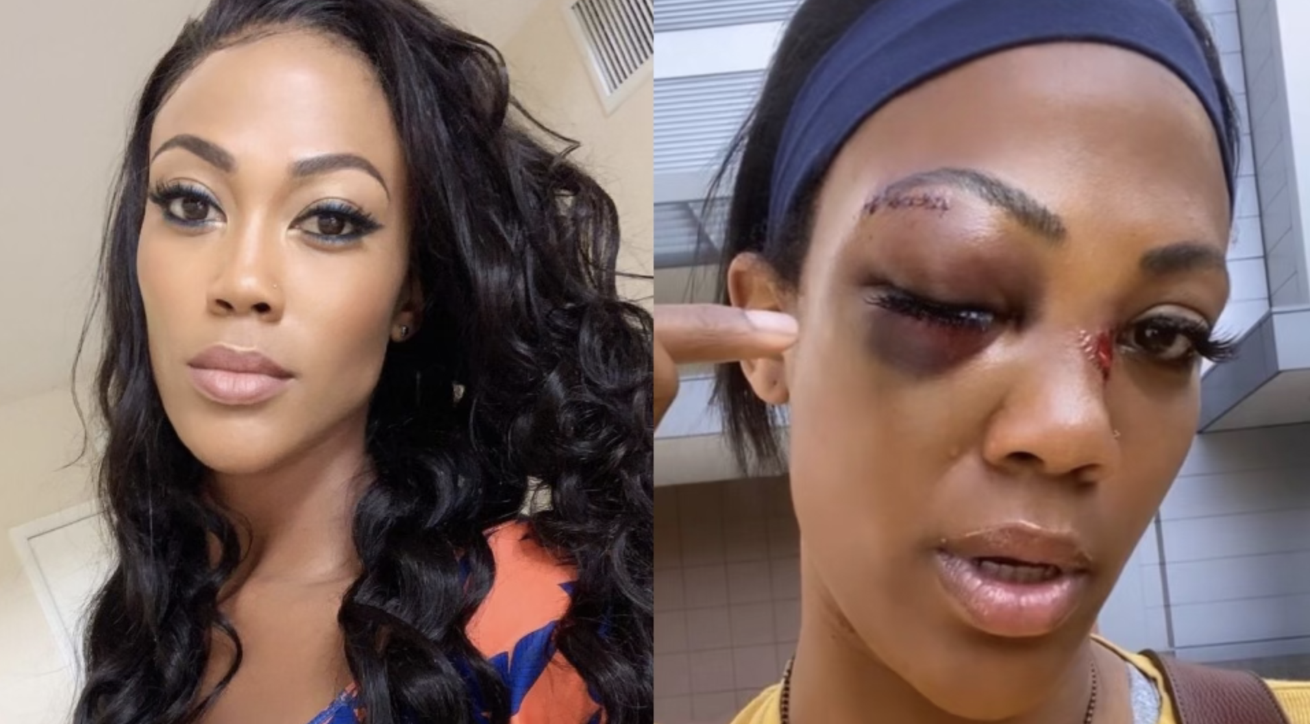 Known Felon Charged With Assault for Attacking Olympian Kim Glass