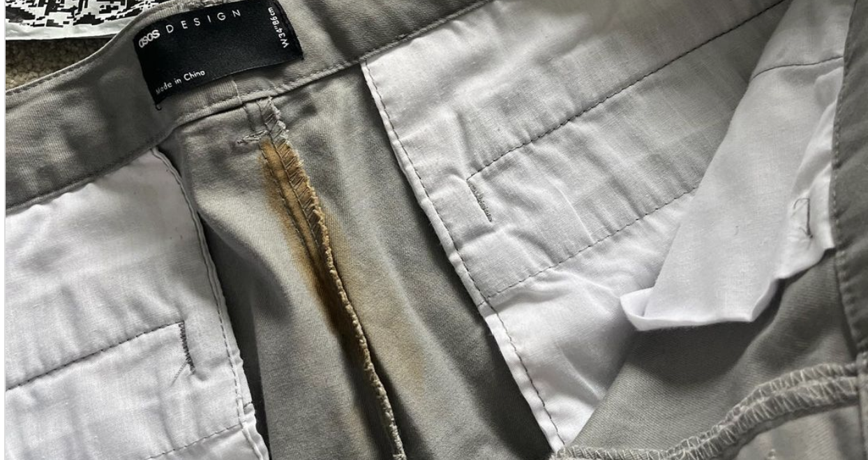 Woman Alleged Shorts Bought From Online Clothing Retailer ASOS Came With A Poop Stain On Them