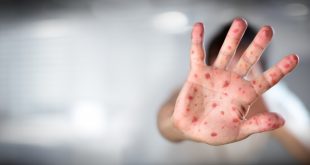 WHO and CDC Says COVID Is To Blame For Measles Being An "Imminent Threat" Worldwide