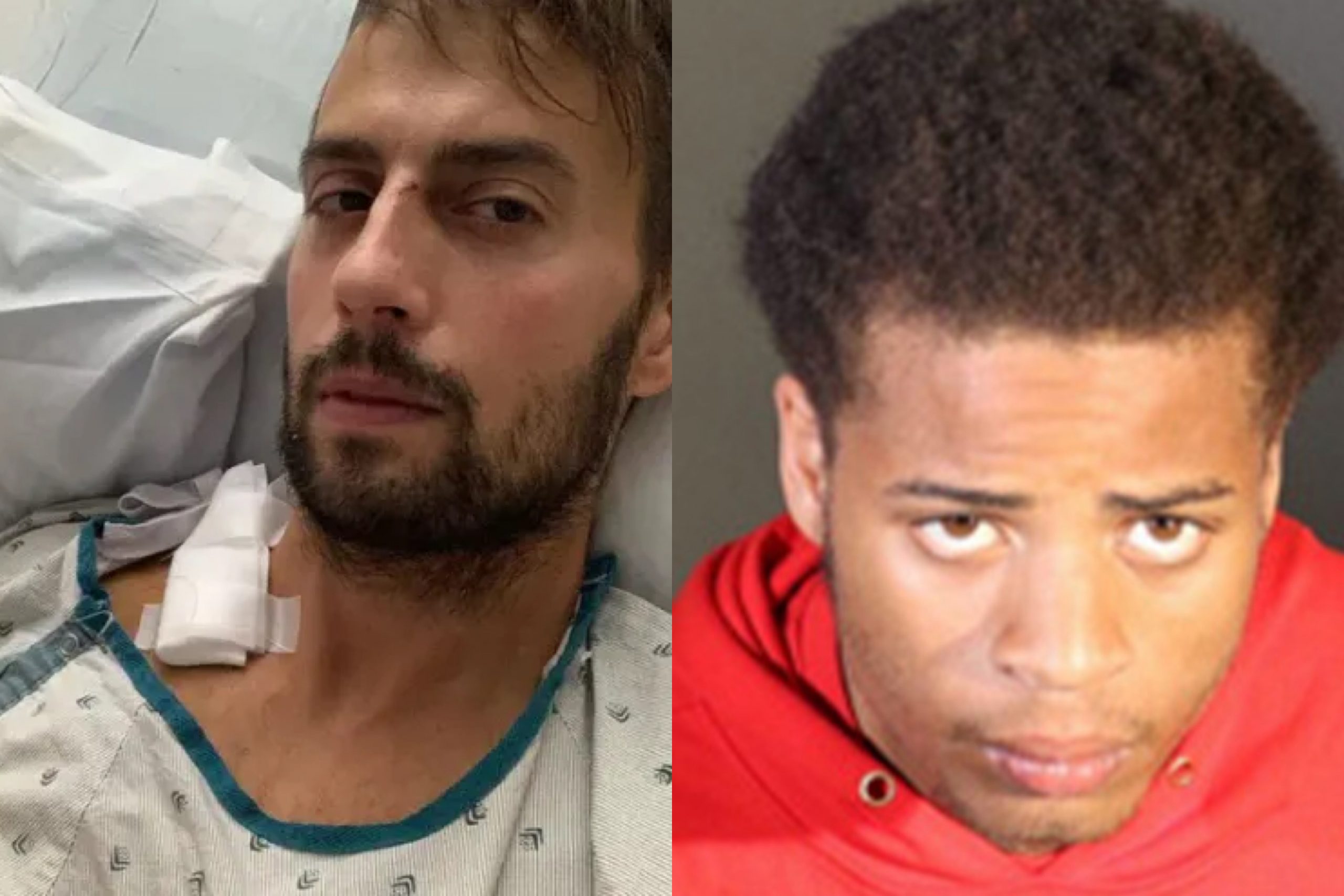 Man Who Shot Lady Gaga's Dog Walker Sentenced to 21 Years in Prison