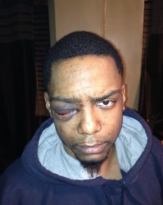 Black Man Awarded .5 Million After He Was Attacked By Religious Patrol Group