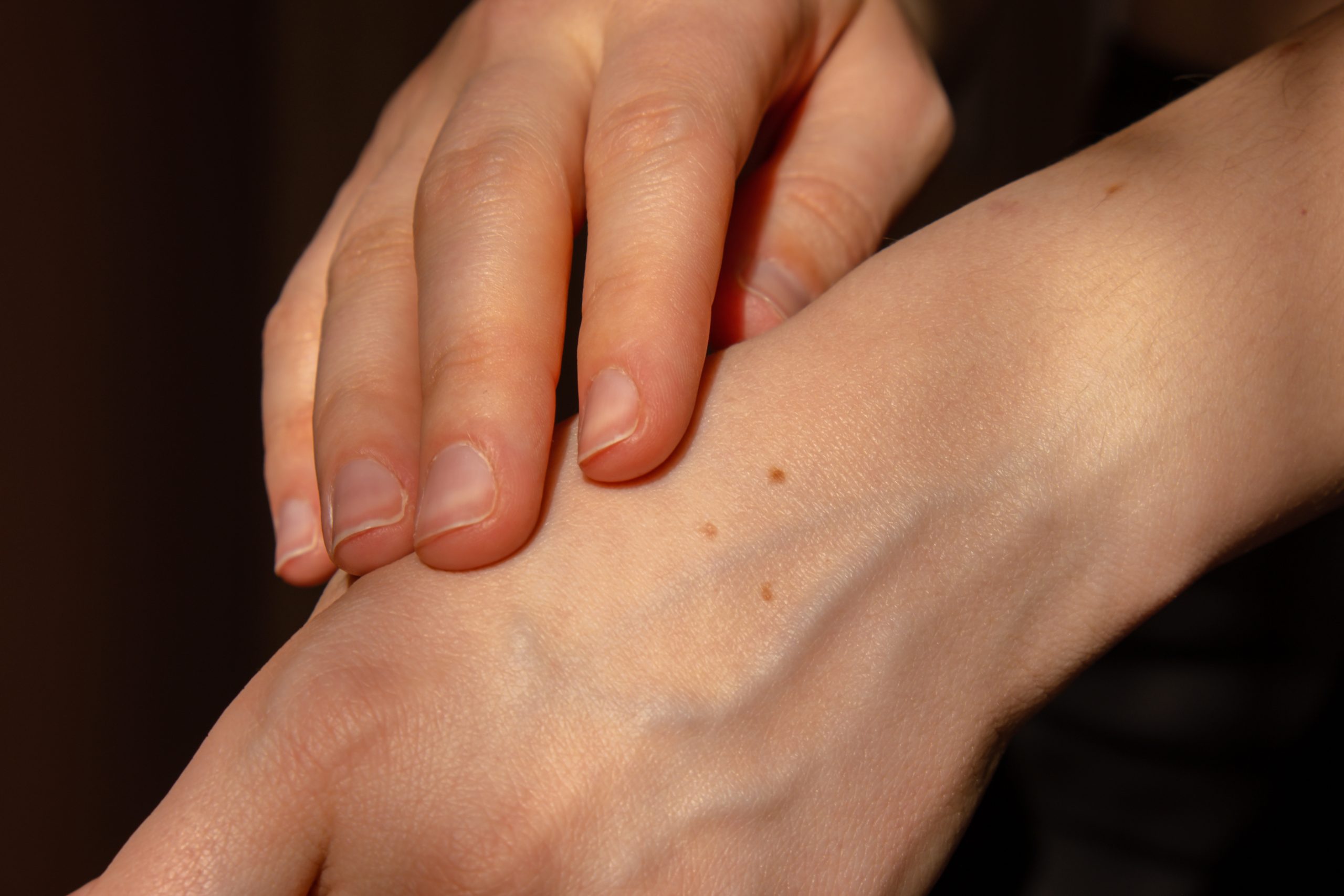 Florida Man Bit By Relative Develops Painful Flesh Eating Disease