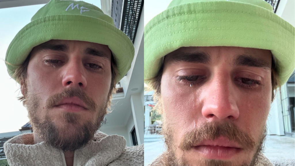 Justin Bieber Fans Send Him Support Online After He Shares Concerning Crying Selfies