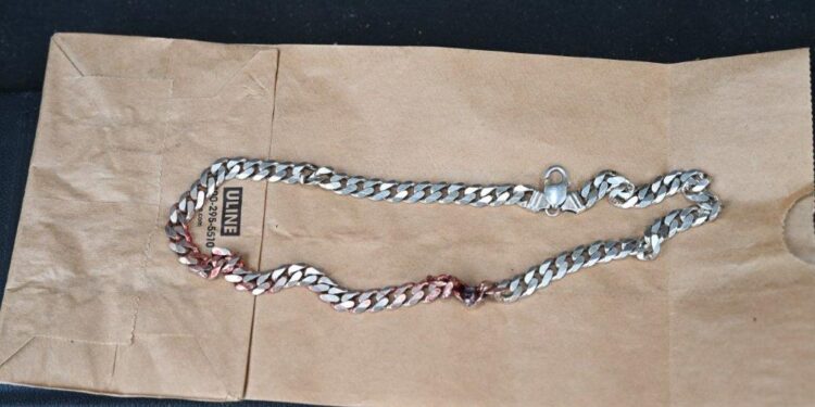 Man Literally Dodges Bullet Thanks to Chain Necklace