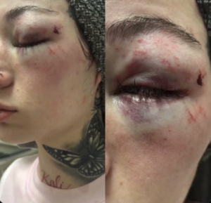 Bhad Bhabie Posts Shocking Assault Video of Ex-Boyfriend