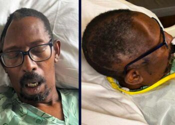 Georgia Man Sues After Hospital Loses Part of His Skull, Then Charges Him $19K for Replacement