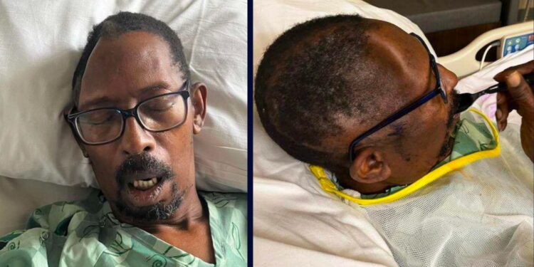Georgia Man Sues After Hospital Loses Part of His Skull, Then Charges Him $19K for Replacement