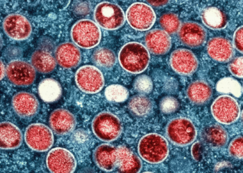 Shockwaves in Public Health: First U.S. Case of Severe Clade I Mpox Confirmed
