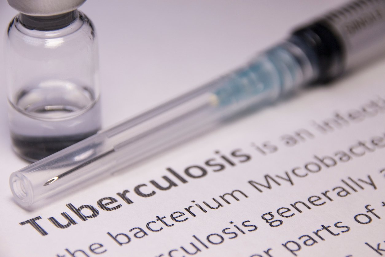 Kansas Faces Largest Tuberculosis Outbreak in U.S. History Amid Public