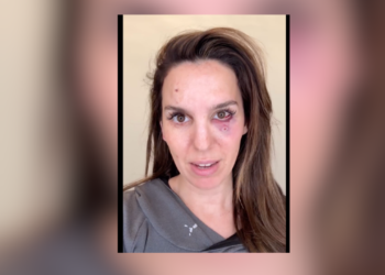 Kim Possible Star Christy Carlson Romano Shares Grateful Message After Being Shot in the Face