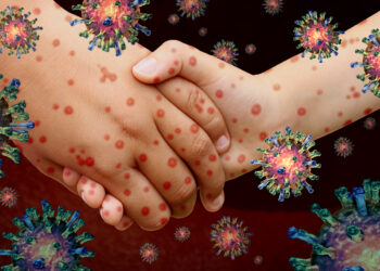 Measles Could Surge to 51 Million Cases in 25 Years if Vaccination Rates Continue to Drop, Study Warns