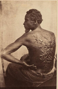 the scourged back - Baller Alert the scourged back