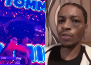 Tommie Lee Says It Was Plastic, Not Glass — Denies Blame After Fan Claims She Sent Him to the ER