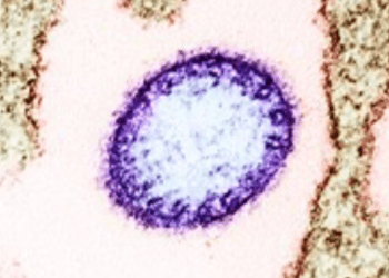 Nipah Virus