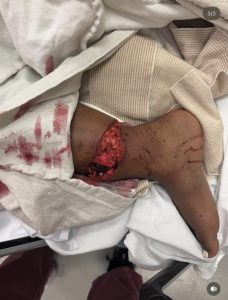 Gloss Up Foot