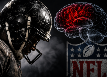 The NFL’s Billion Dollar Machine Has A Brain Injury Problem: CTE Found In At Least 1 In 4 Former Players